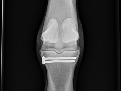 Fracture Repair in Thoroughbred Racehorses Image 6